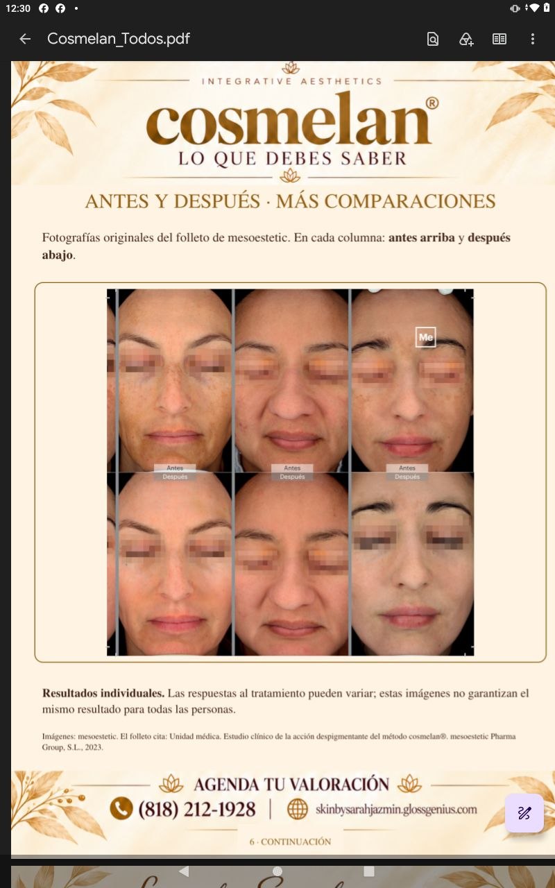 Cosmelan · Antes y después